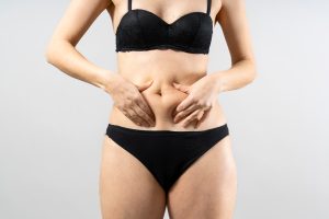 Mini tummy tuck article image